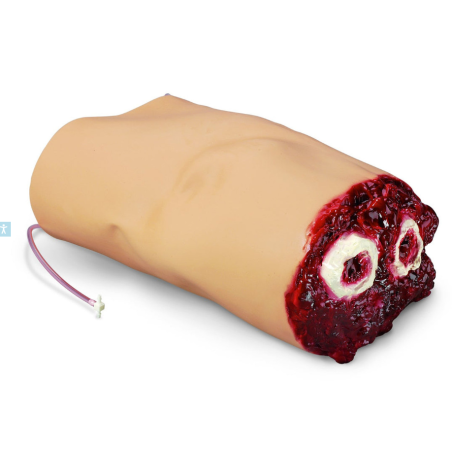 Simulaids Amputated Bleeding Arm for SMART STAT Patient Simulator